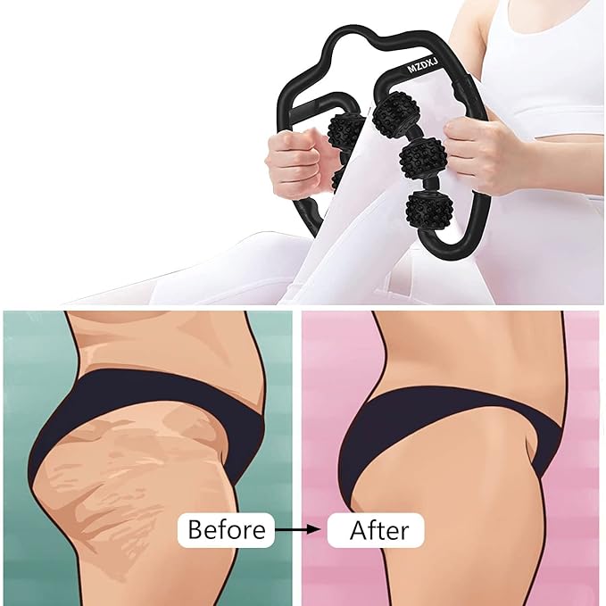 Cellulite Massage Tool Muscle Roller - Deep Fascia Massager & Dimpled Skin Remover for Legs, Thighs & Buttocks - Anti-Cellulite Roller, Smooth Skin, Pain Relief（Black - 6 Wheel）